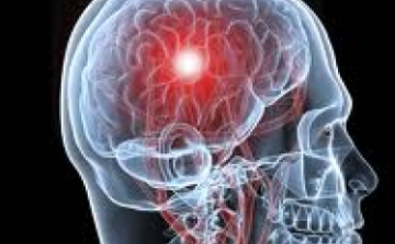 Veszélyesebb a látáskieséssel járó TIA