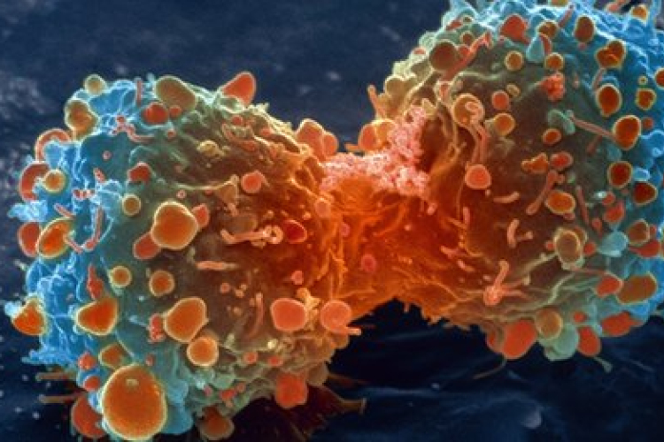 A rák évi 126 milliárd euróba került az Európai Uniónak 2009-ben