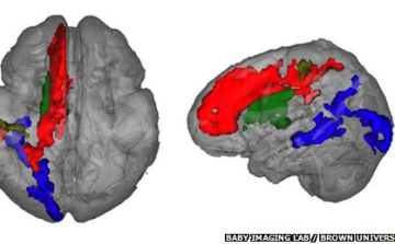 Négyéves kor előtt kezelhető hatékonyan a nyelvi lemaradás kutatók szerint